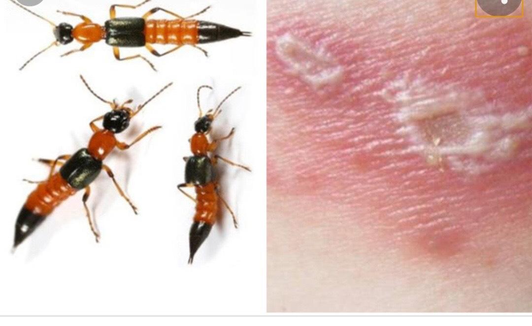 Thuốc diệt Kiến Ba Khoang Fendona 10sc chai 50ml không mùi của Đức